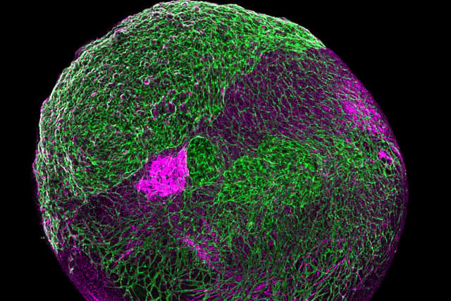 Lead researcher, Dr Mihai Lomora, acknowledged that that the work “might sound like science fiction” but said the reality is “not so far fetched” and scientists all around the world are working on such organoids.