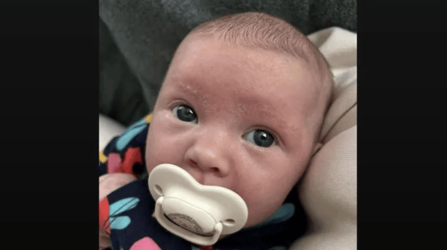 'She is a fighter and is doing her best to keep stable'- Mother of baby girl born with rare condition
