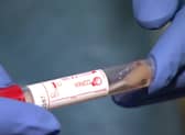 Coronavirus Covid-19 testing has reached 1,000