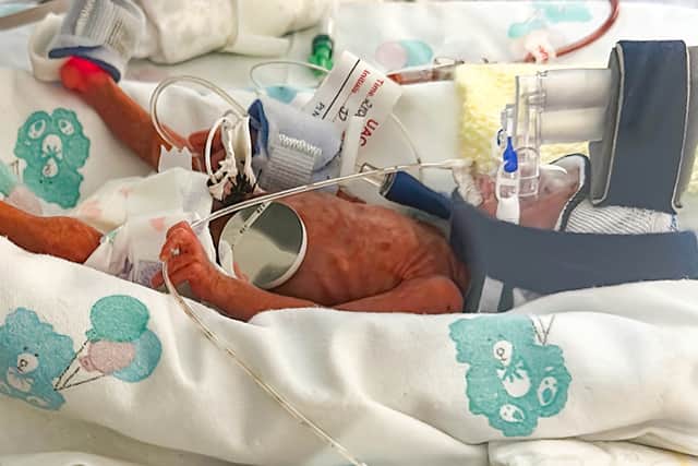 But despite multiple health scares and complications during four months in hospital, first at the Royal and then at Antrim Area Hospital, Raina battled through and her mother and father were finally able to take her home in October.