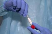Coronavirus Covid-19 testing being expanded says GPs