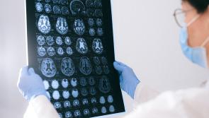 New technology developed to predict early Alzheimer's disease with near 100% accuracy
