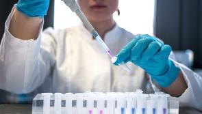 'Always better to be prepared' - Management team set up in Ireland in anticipation of Monkeypox 
