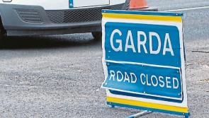 Young man being treated for serious injuries after an early morning hit-and-run