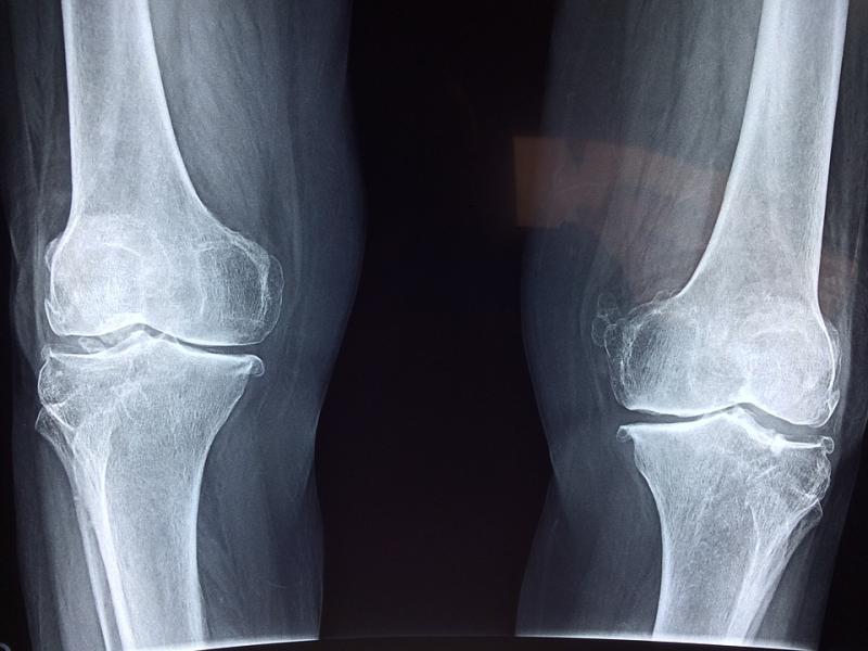 Some hospital patients accidentally exposed to radiation 