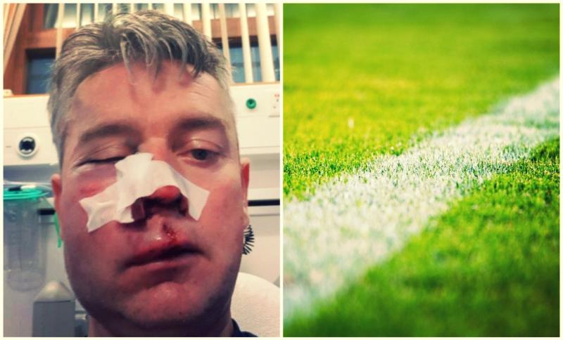 OPINION: 'Ah ref!' - Mouthy sideline parents have created culture of violence in sport