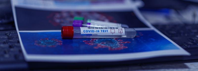 LATEST: 324 confirmed new cases of Covid-19 across Ireland 