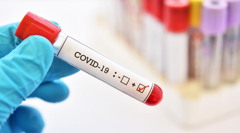 Covid-19 positivity rate of over 50% recorded this week, latest data reveals