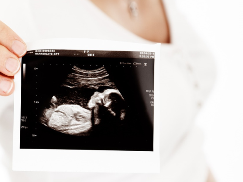  Irish people with infertility can soon avail of public IVF as start date revealed