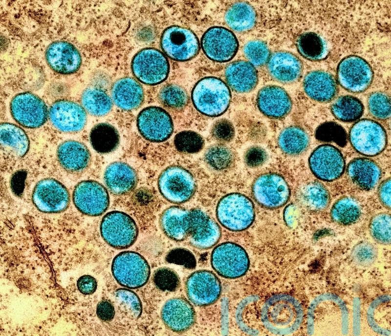 Vaccination advice for groups most at risk of monkeypox in Carlow to be issued soon
