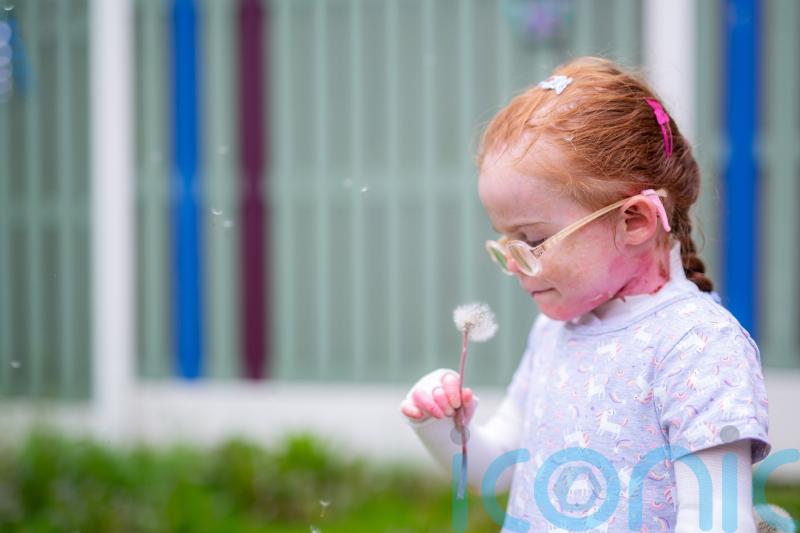Girl with rare skin disease stars in book explaining disorder to classmates