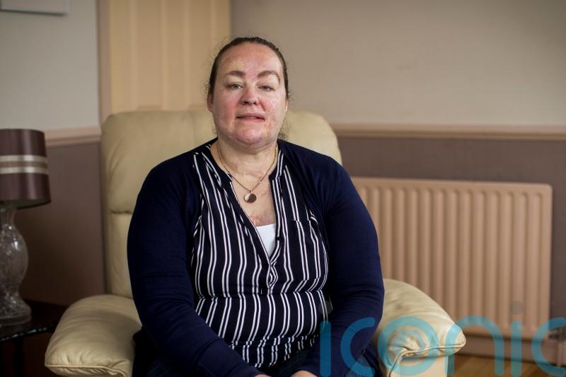 Woman burned in Omagh bombing was ‘given last rites four times’